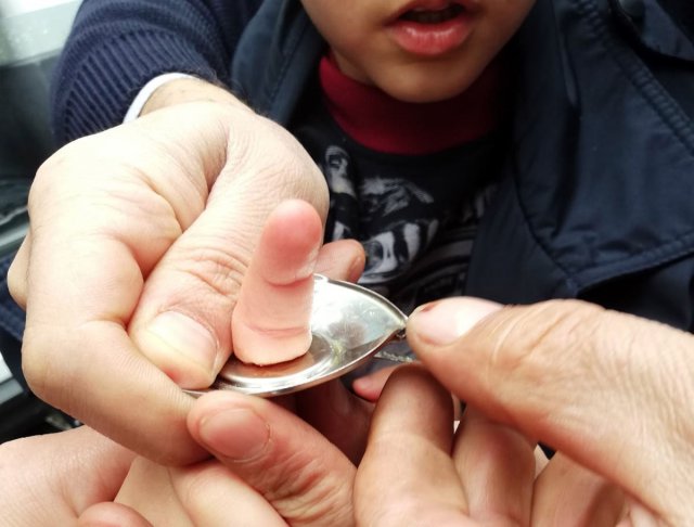 Çocuğun parmağı su matarasına sıkışınca..